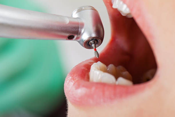 Best Dentist for Dental Trauma  in Hughesville, PA